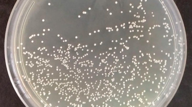 Seu intestino pede ajuda? Entenda como escolher um probiótico